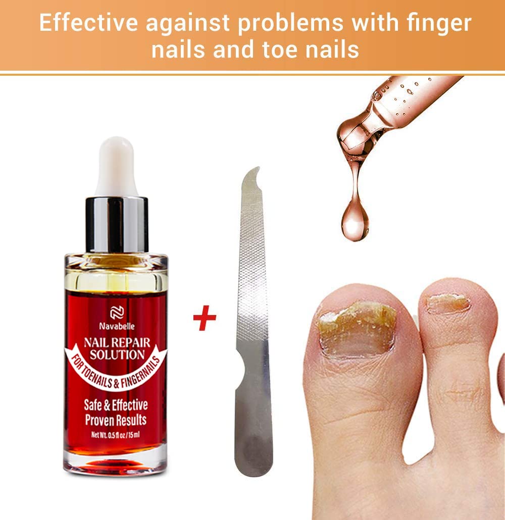 Excilor Ultra Nail Fungus Treatment | Health | Superdrug